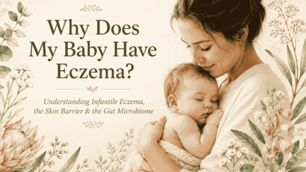 An illustrated picture of a mother holding a baby. Soft tomes - writing why does my baby have eczema