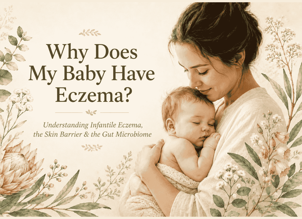 An illustrated picture of a mother holding a baby. Soft tomes - writing why does my baby have eczema
